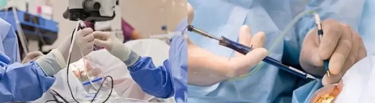 Chirurgie pentru restabilirea vederii